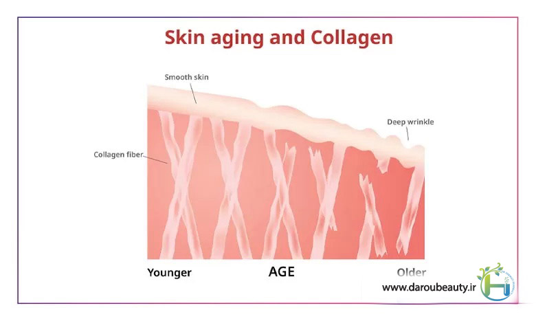 کلاژن چیست و چگونه کلاژن سازی به پوست خود کمک میکنه؟